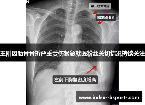 王刚因肋骨骨折严重受伤紧急就医粉丝关切情况持续关注